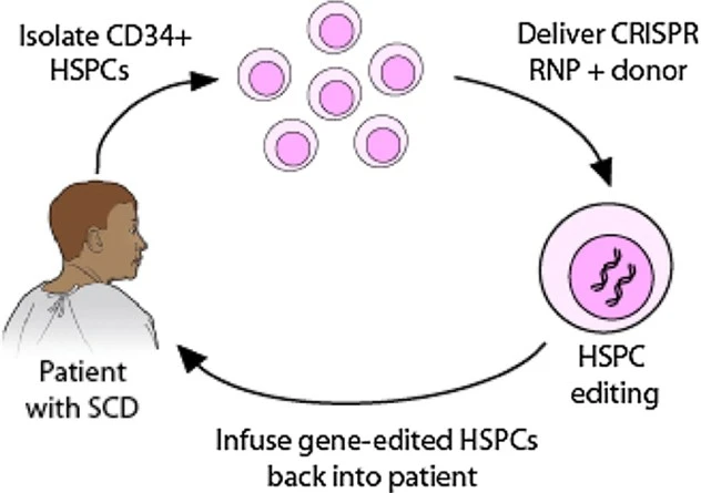 Genome editing-based strategy for treating sickle cell disease.