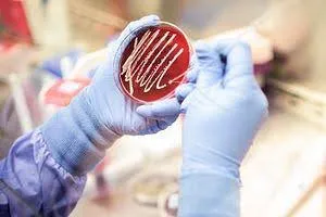 contamination management and role of microbiologist contamination management and role of microbiologist